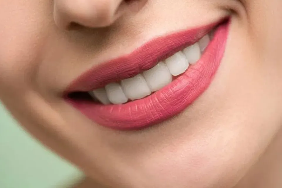 Air flow fogtisztítás fogpolírozással a Hollán Dentnél – 1. kép
