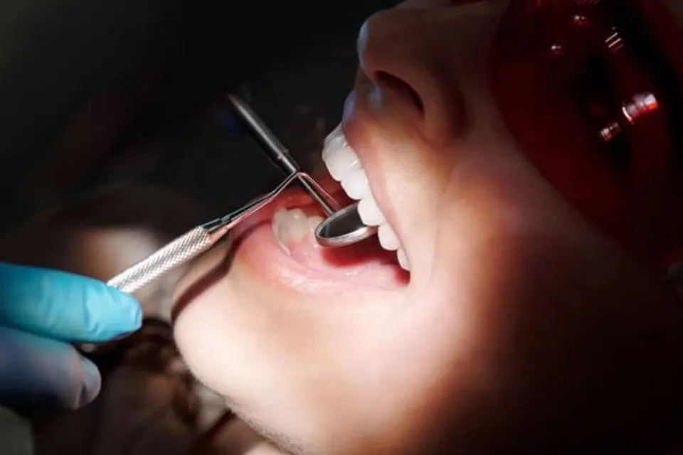 Fix patentos fogsor 4 implantátummal, konzultációval és panoráma röntgennel – 1. kép